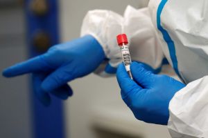Έρευνα: Ποιος ο ρόλος των λεμφοκυττάρων στην προστασία από τη λοίμωξη Covid-19;