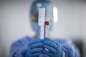 Νέα στοιχεία από τις τελευταίες δοκιμές του εμβολίου της Johnson &amp; Johnson