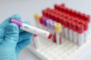 Ηπατίτιδα C: Υπάρχει οριστική θεραπεία και οι ασθενείς πρέπει να την αναζητούν