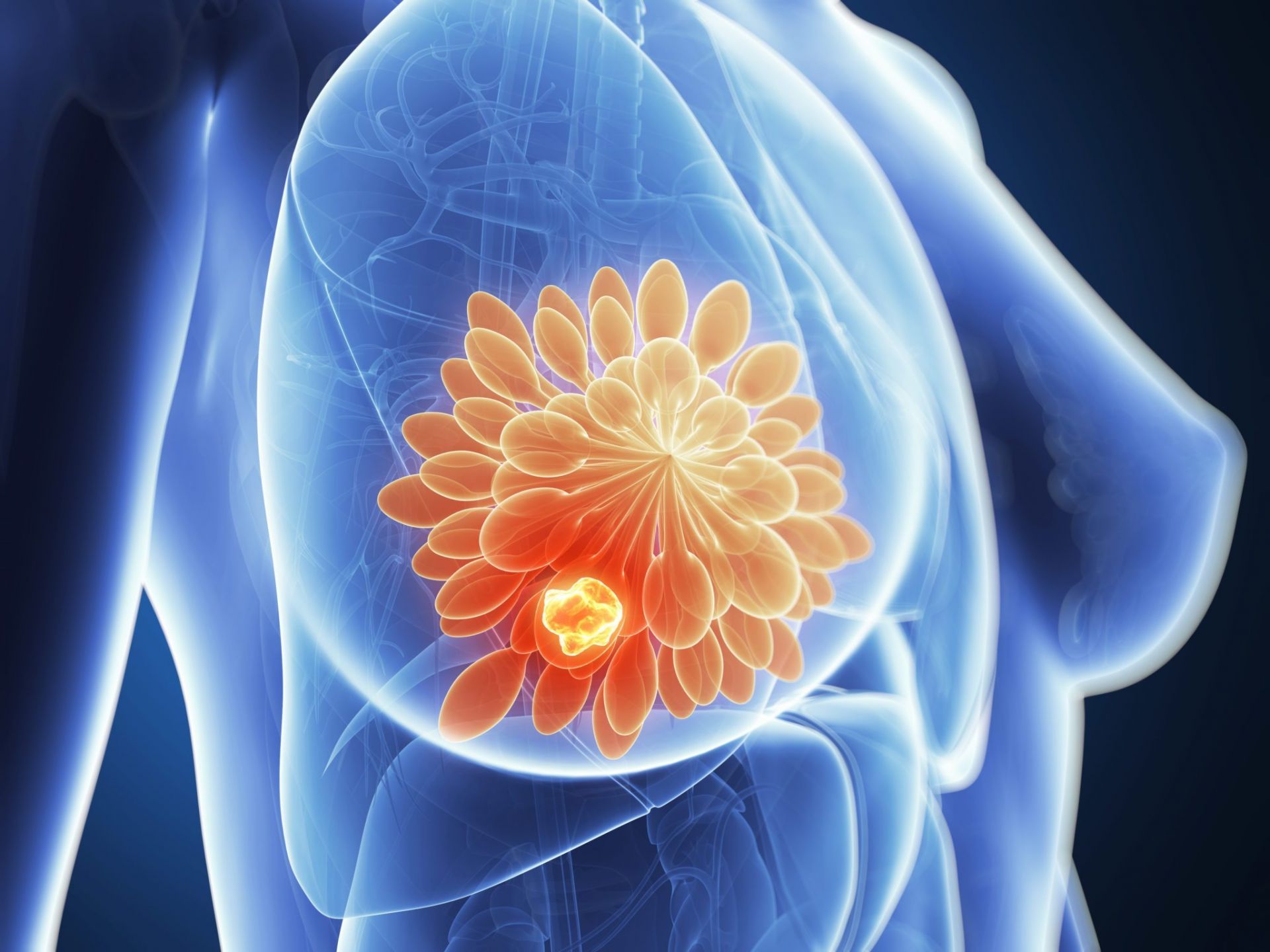 Σήμερα η επιστήμη διαθέτει πολλά όπλα κατά του καρκίνου του μαστού