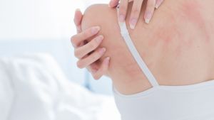 Έκζεμα: Επηρεάζει το περιβάλλον την υγεία του δέρματος;
