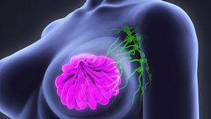 Η χειρουργική μαστού και η ανάπλαση του στήθους μετά τη μαστεκτομή